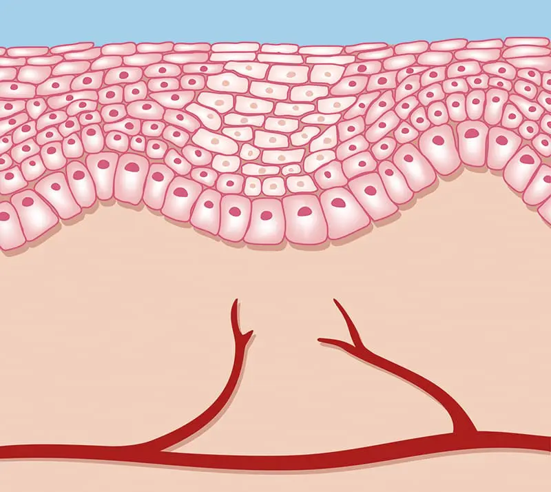 Wundheilung Regeneration
