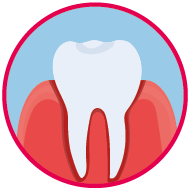 Icon für einen Zahn mit Gingivitis.