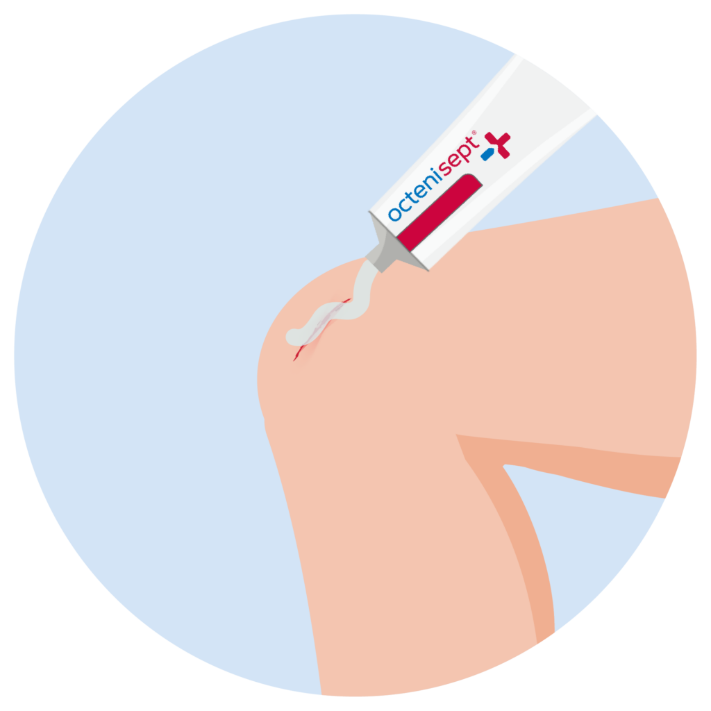 octenisept® Gel wird auf eine Wunde am Knie aufgetragen, um den Wundverschluss zu fördern und vor Keimen zu schützen.